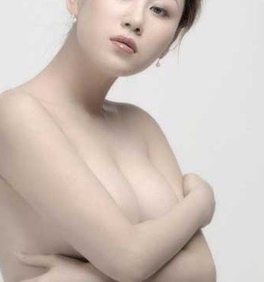 上海自体隆胸有没有风险
