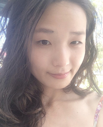 park法重睑术1