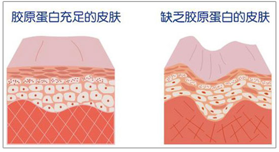 大多数仪器美容能真正刺激胶原再生