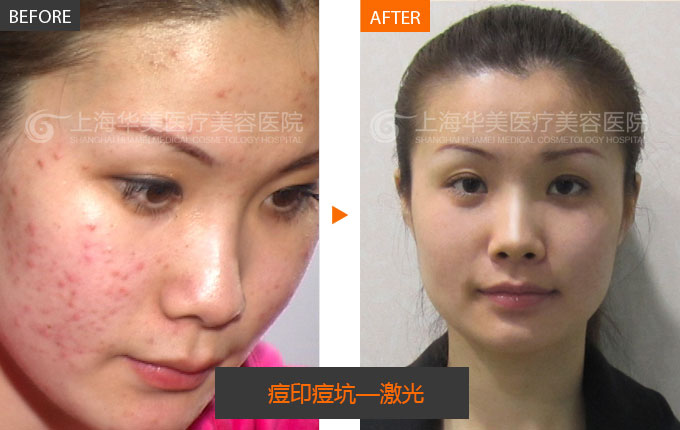 仪器美容好,但是关键在于美肤医生