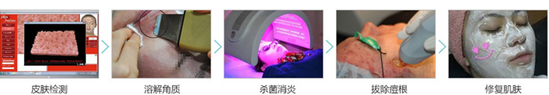 祛痘美肤一步到位