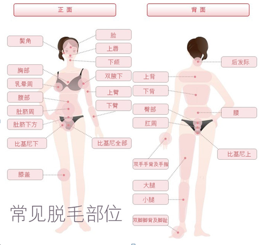 冰点脱毛有没有副作用