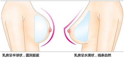 华美丰胸方案