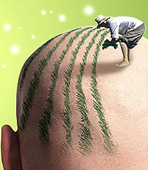哪些人是不适合植发的?