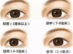 双眼皮做的太宽会有哪些影响?
