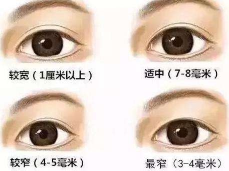 双眼皮做的太宽会有哪些影响?